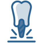 Root Canal Treatment (RCT)